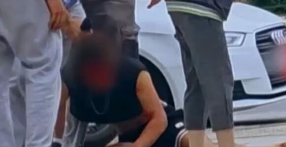 Καλλιθέα: Κατέρρευσε το σενάριο της διάρρηξης για τους δύο νεαρούς που ξυλοκόπησε με ρόπαλο ο οδοντίατρος
